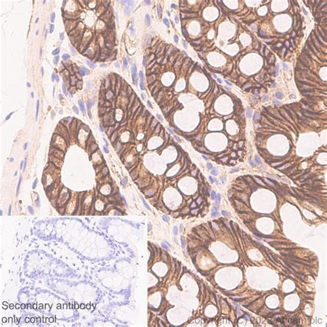 beta catenin antibody|Non.